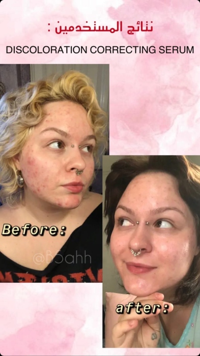 Good molecules, Discoloration Correcting Serum